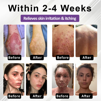 ATTDX® Purple Corn Multi-Condition Skin Spray