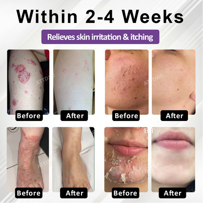 ATTDX® Purple Corn Multi-Condition Skin Spray