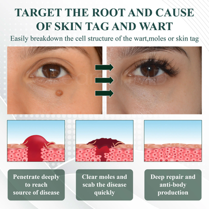 ATTDX® Reedle Shot 100 Tag & Spot Target Advanced Serum