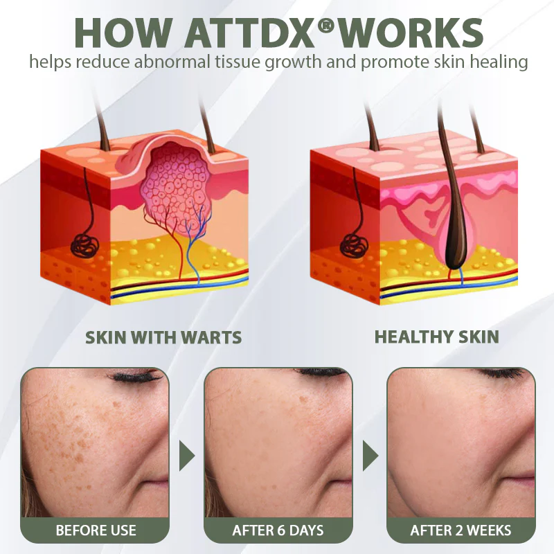 ATTDX® Reedle Shot 100 Tag & Spot Target Advanced Serum