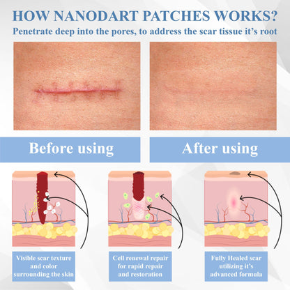 ATTDX® ScarRepair EGF Nanodart Patches