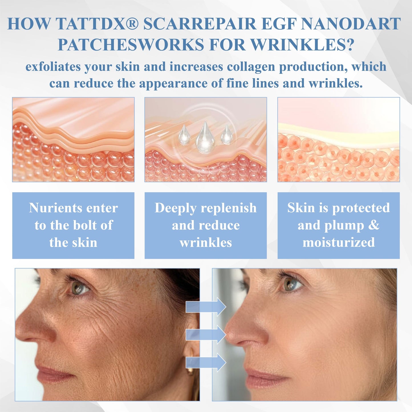 ATTDX® ScarRepair EGF Nanodart Patches
