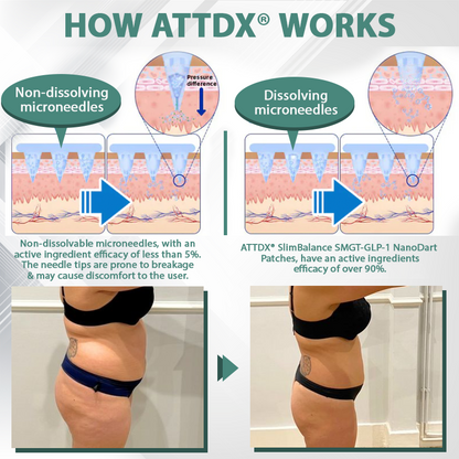 ATTDX® SlimBalance SMGT-GLP-1 NanoDart Patches