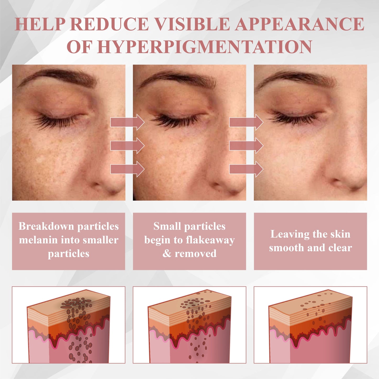 ATTDX® NanoDart Skin Tag Removal Patches