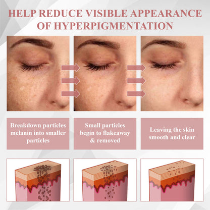 ATTDX® NanoDart Skin Tag Removal Patches