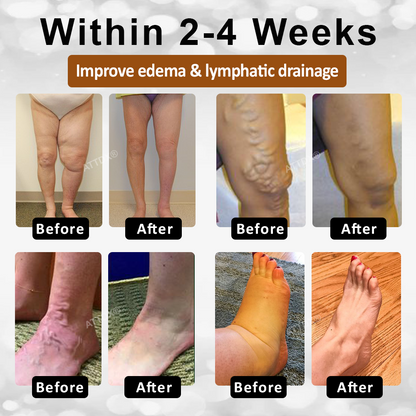 ATTDX® TallowCollagen Lymph Relief Bee Balm
