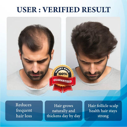 ThickBoost Herbal HairGrowth Serum for Men 2