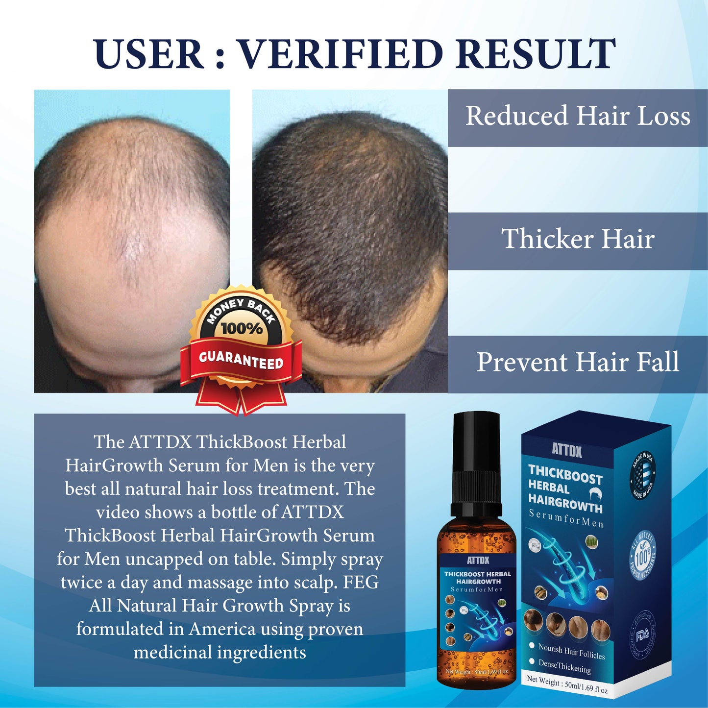 ThickBoost Herbal HairGrowth Serum for Men