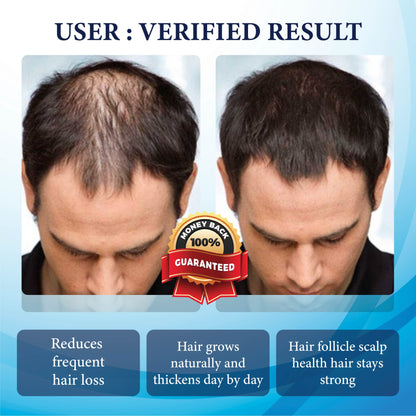 ThickBoost Herbal HairGrowth Serum for Men