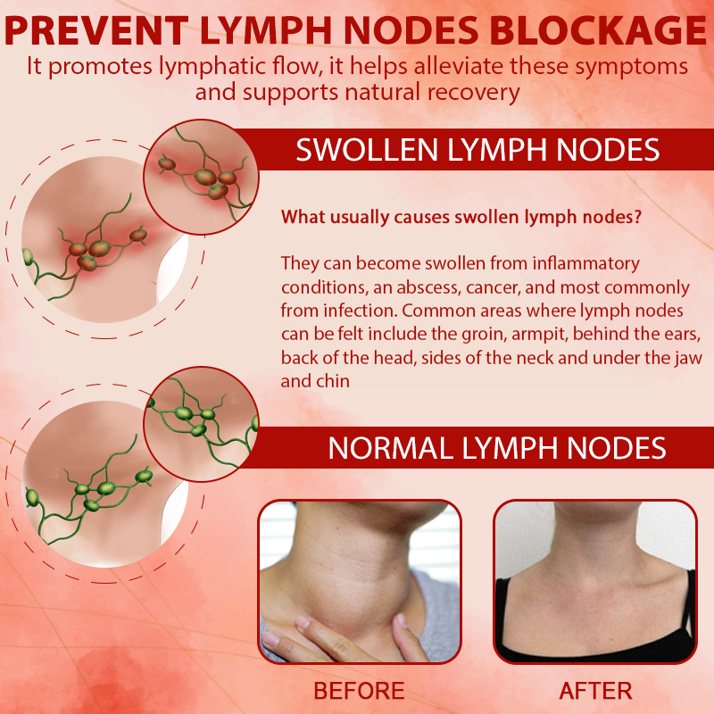 ApisHeal™ ApisVenom EdemaSupport Lymphatic Detox Cream