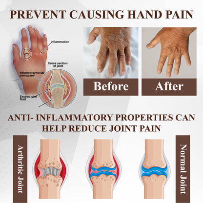 ApisRelief™ Bee and Horse Chestnut Joint Therapy Cream