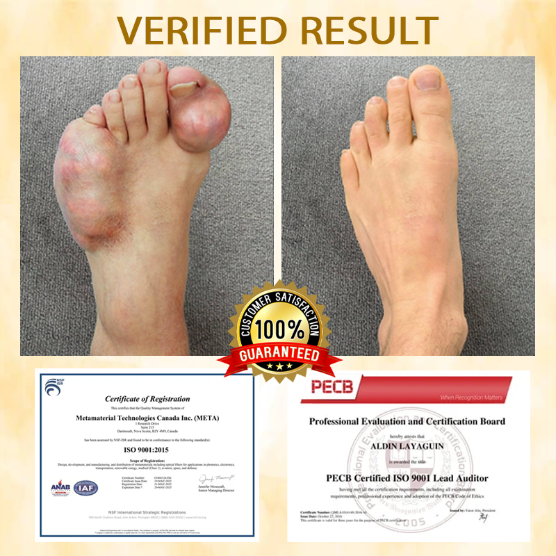 ATTDX® BeeEase MicroSting Joint Patches