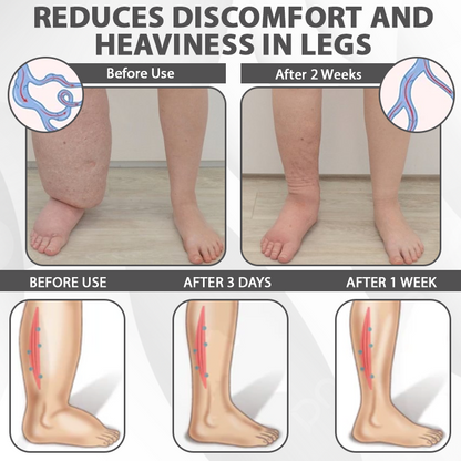 DetoxFlow™ EdemaRelief Lymphatic Detox Cream