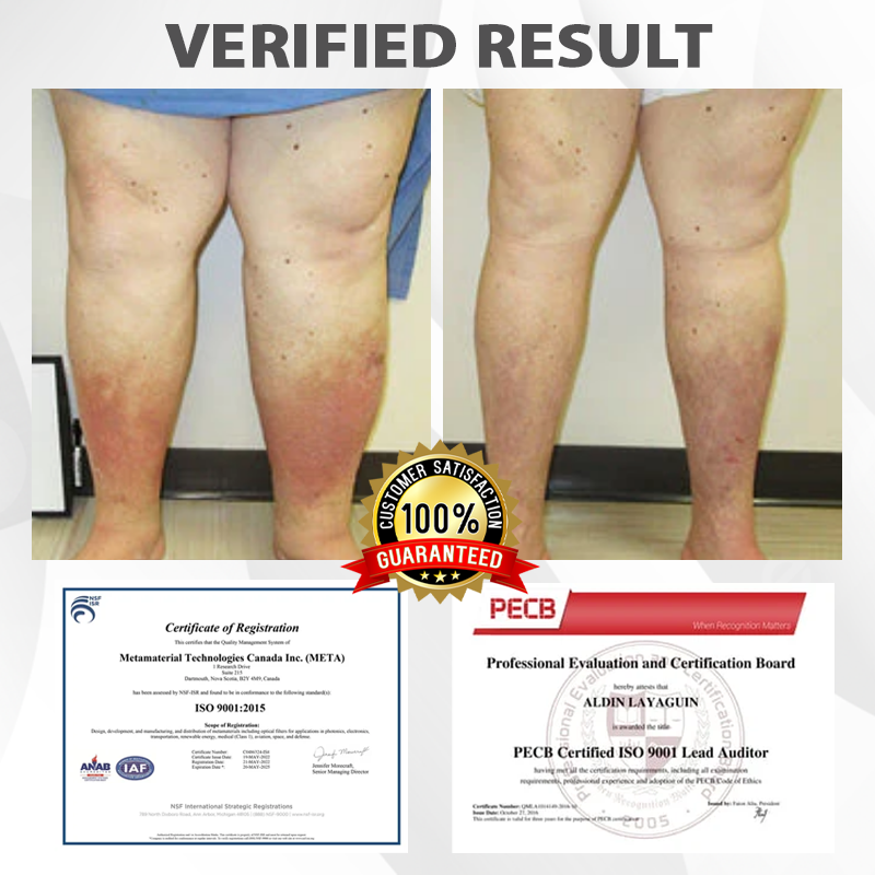 DetoxFlow™ EdemaRelief Lymphatic Detox Cream