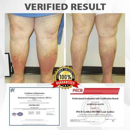 DetoxFlow™ EdemaRelief Lymphatic Detox Cream