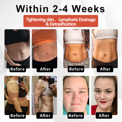 ApisThera™ LymphDetox FirmingBee Bath Beads