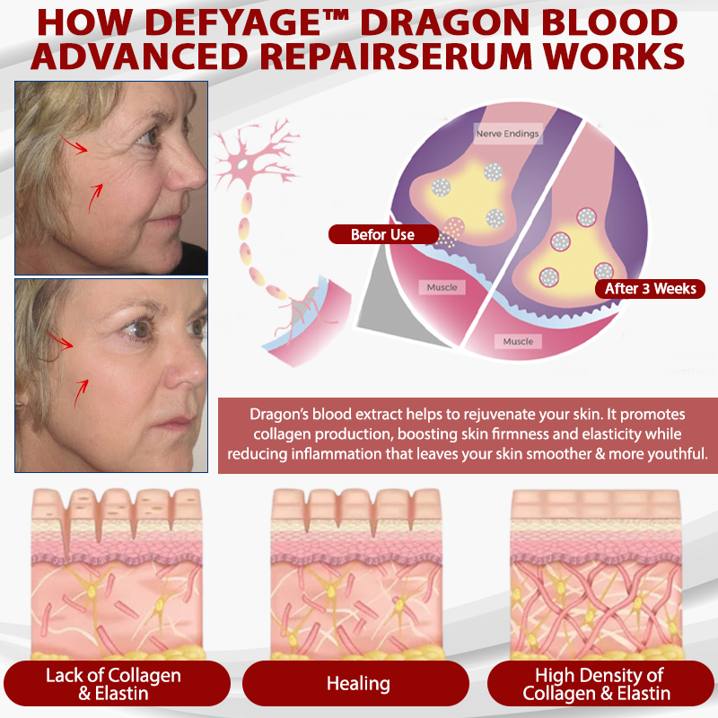 DefyAge™ Dragon Blood Advanced RepairSerum