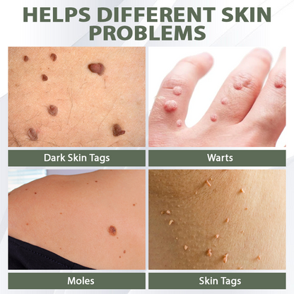 DermaEase™ Spotless Tag and WartRemoval Gel