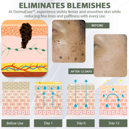 DermaEase™ Spotless Tag and WartRemoval Gel