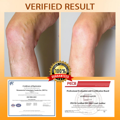 ATTDX® MicroSting Bee Vein Ease Patches