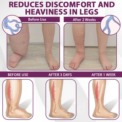 EdemaCare™ Elderberry Lymphatic Massage Cream
