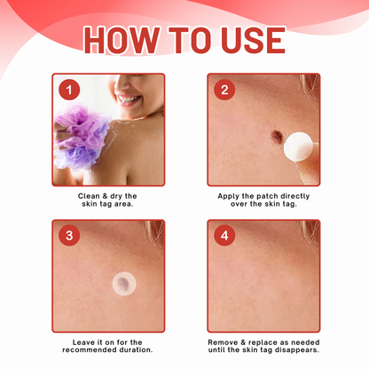 DermaEase™ MicroDart Skin Tag Remover Patch