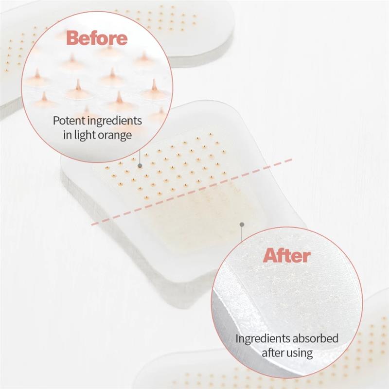 ATTDX® BeeEase MicroSting Joint Patches
