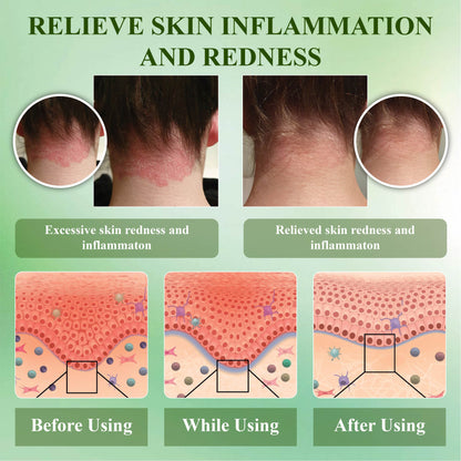 RelievaDerm™ Aloe SkinTherapy  HydratingGel
