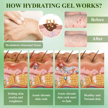 RelievaDerm™ Aloe SkinTherapy  HydratingGel