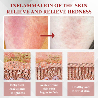 RelievaDerm™ Emu Oil Skin Therapy Botanical Ointment
