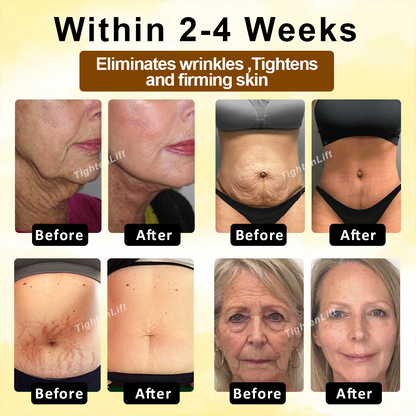 TightenLift™ Botox Sheep Placenta MultiFirming Cream