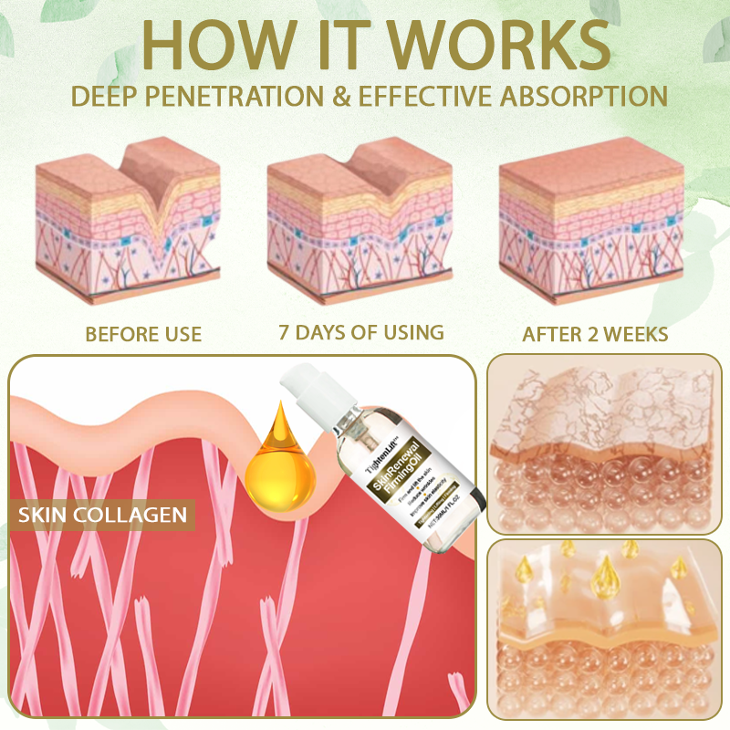 TightenLift™ SkinRenewal FirmingOil